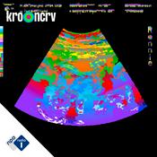 Podcast Ronnie. Op zoek naar een utopie.